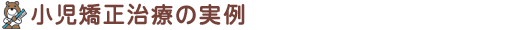 小児矯正治療の実例