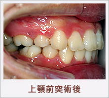 ��{�O�ˏp��