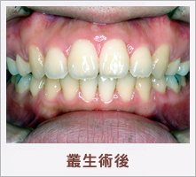 �p���p��