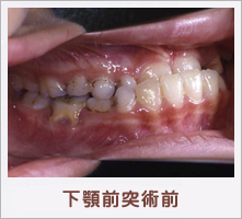 ���{�O�ˏp�O