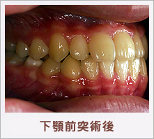 ���{�O�ˏp��