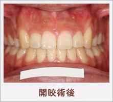 �J���p��